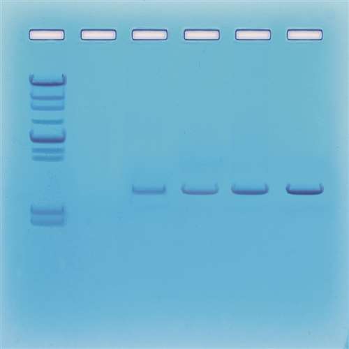 DNA Fingerprinting Using Enzymes School Science Equipment Brecklandscientific co uk